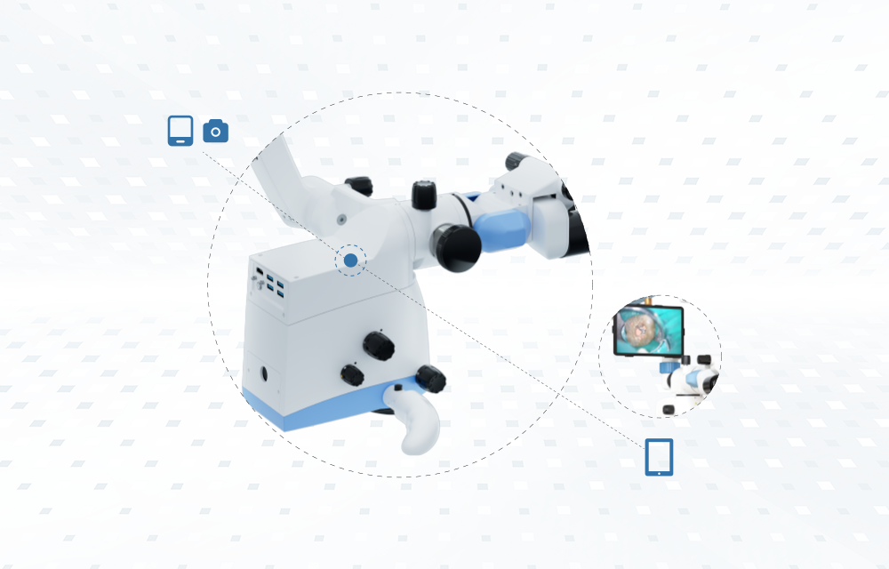 Compared to traditional side-mounted beam splitter interfaces, Zumax’s rear beam splitter interface for the iPad mini stands out as a groundbreaking innovative design. Integrated with a 90°optical extender and paired with the new Type-C imaging interface, it allows dentists to view the LCD screen of compatible digital devices directly in front of them during procedures, eliminating the need to turn their heads left or right.(Note: The rear beam splitter interface is not compatible with the Ultra HD 4K imaging module.)