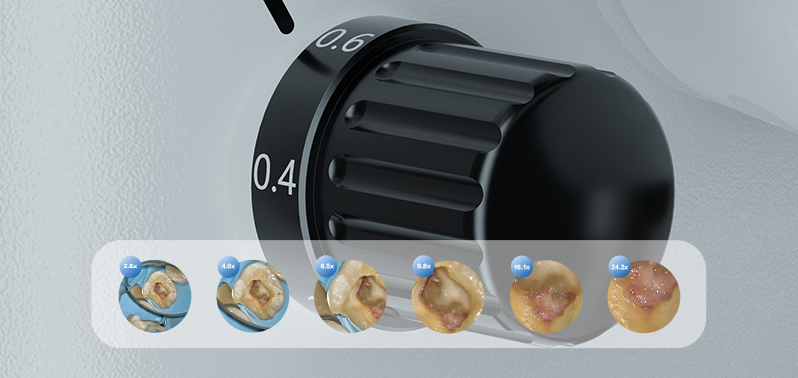 6-step Magnification
